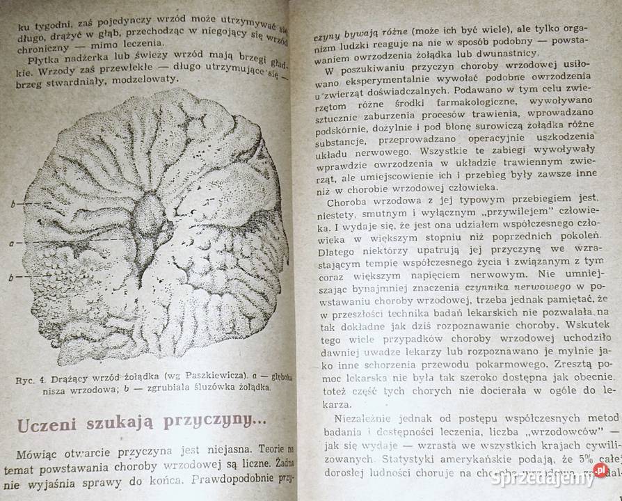 Wrzód żołądka i dwunastnicy Jan Hipolit Bayer lubelskie