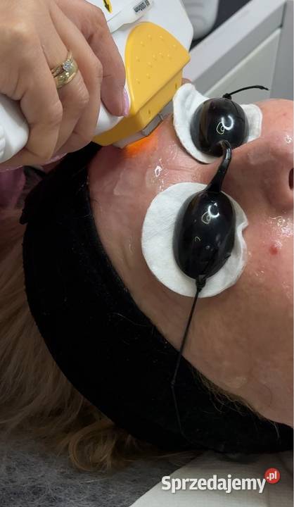 Fotoodmladzanie ipl Pozostałe Chorzów zdrowie