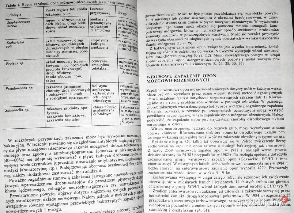 Ostre bóle głowy Antoni Prusiński Chełm sprzedam