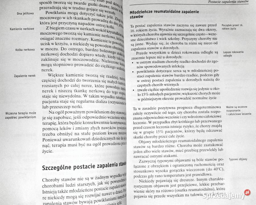 Choroby stawów Gerhard Leibold