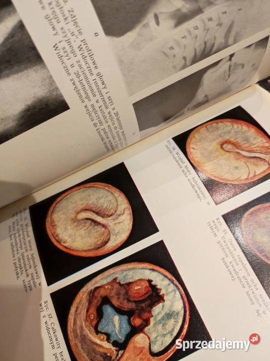 Podręcznik otorynolaryngologii Jan Szymański Kielce sprzedam