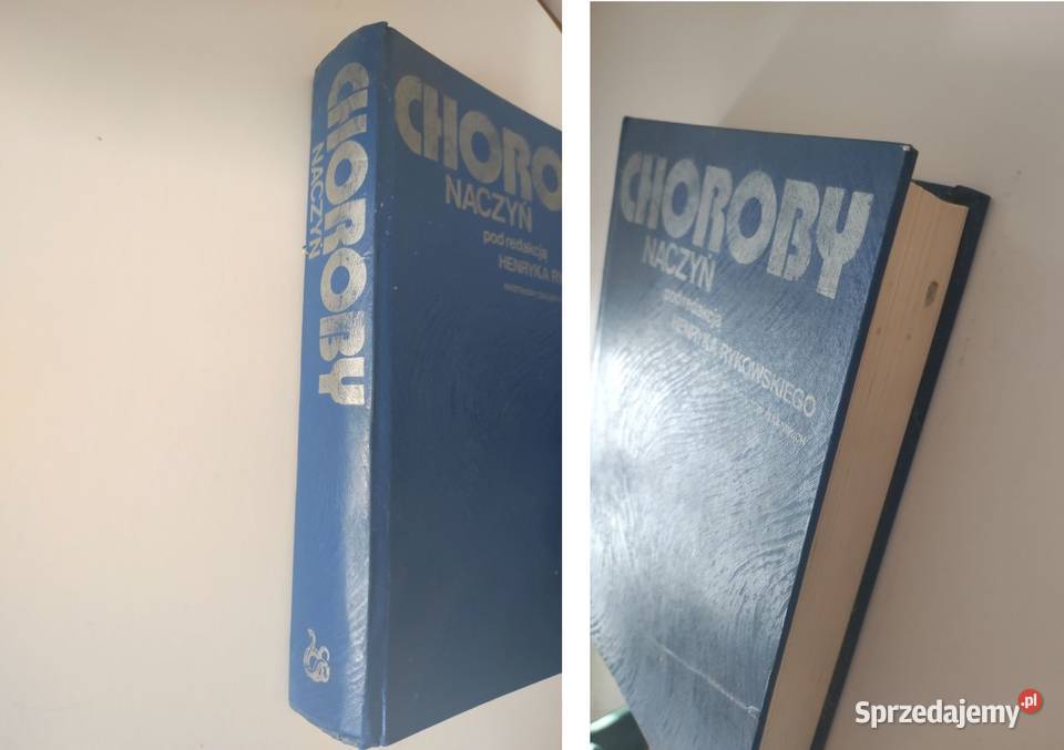 książka medyczna Choroby naczyń Henryk Rykowski Pozostałe Kielce