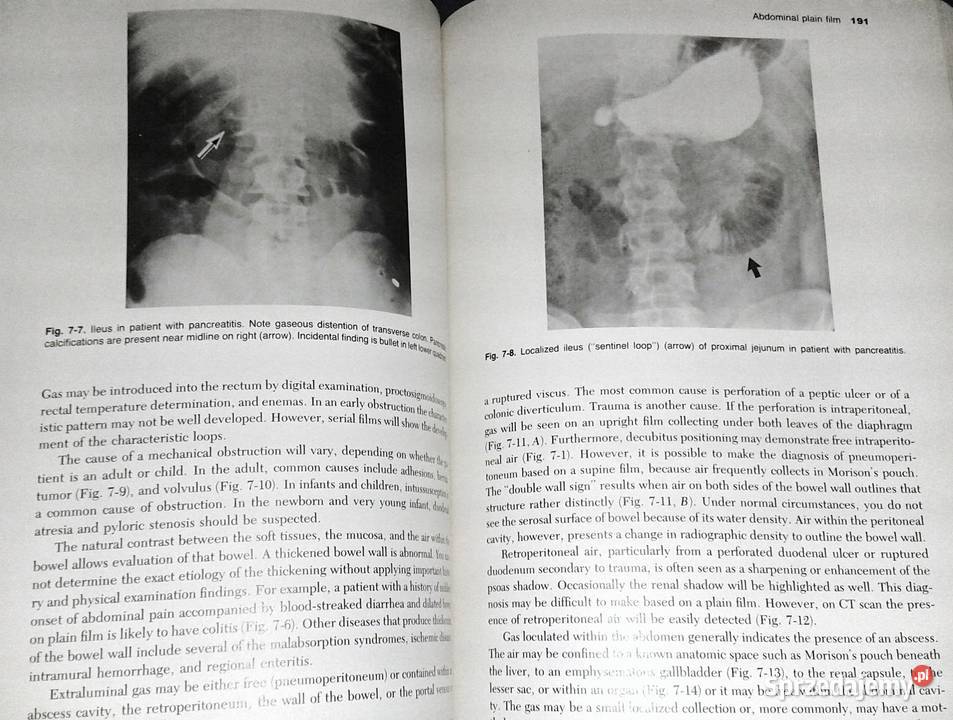 Introduction to Clinical Radiology Richard Chełm