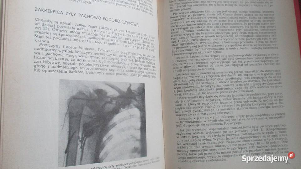 Choroby naczyń HRykowski medycyna naczynia medycyna, nauki medyczne Łódź