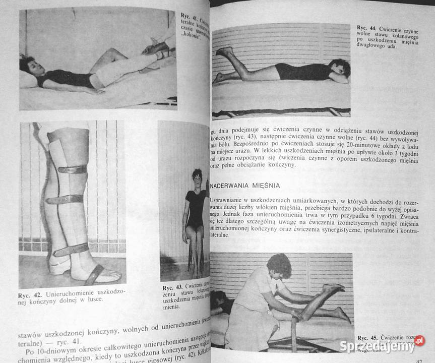 Ćwiczenia usprawniajace w uszkodzeniach kości i Chełm