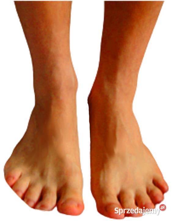 JONOFOREZA URZĄDZENIE NADPOTLIWOŚĆ POCENIE DŁONI