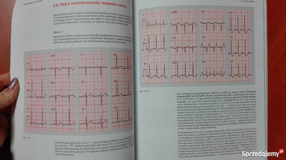 Elektrokardiogram Bez Tajemnic Andrzej Stanke Rok wydania 2002 Olsztyn