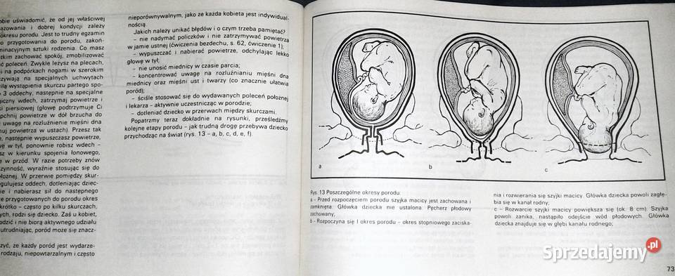 Sztuka rodzenia Bożena Karpińska Rok wydania 1980 Chełm
