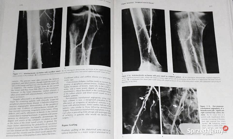 Diagnostic Imaging in Surgery Ronald Eisenberg Chełm