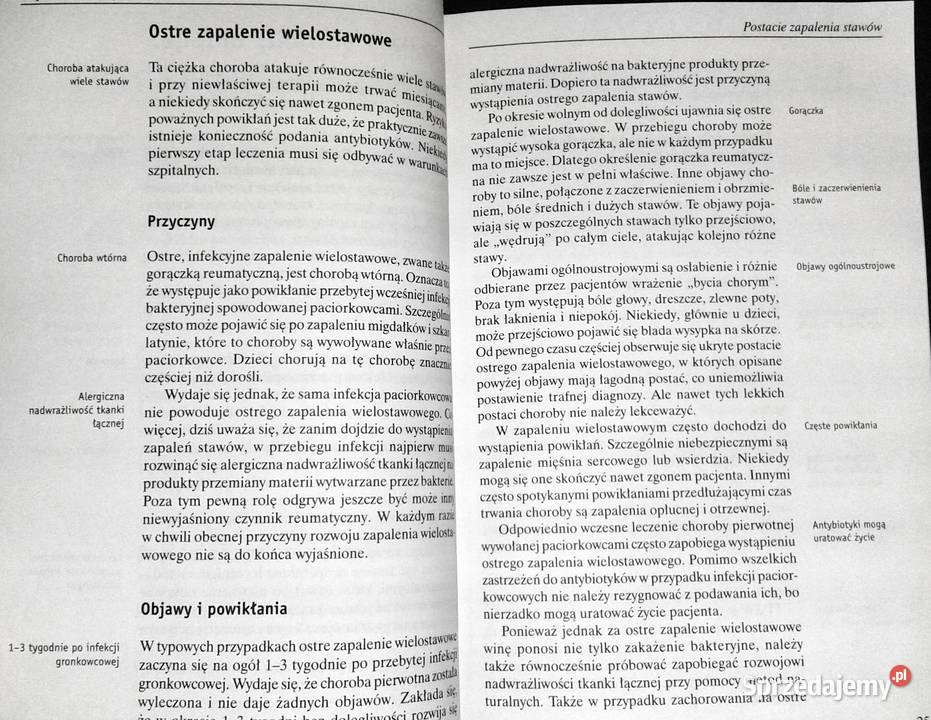 Choroby stawów Gerhard Leibold Rok wydania 2005 Chełm