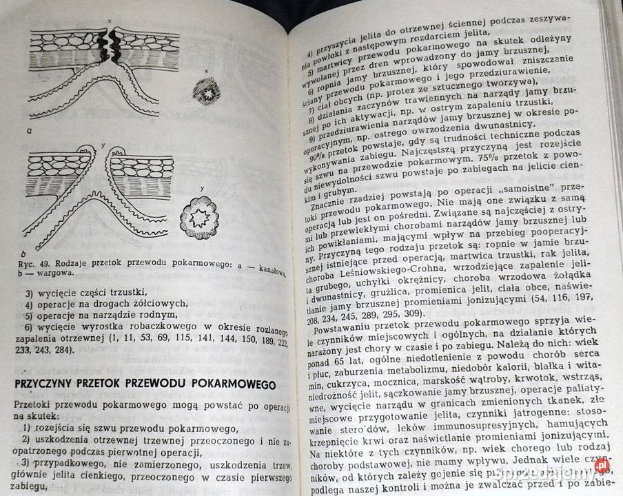 Wczesne powtórne otwarcie jamy brzusznej Leszek Chełm