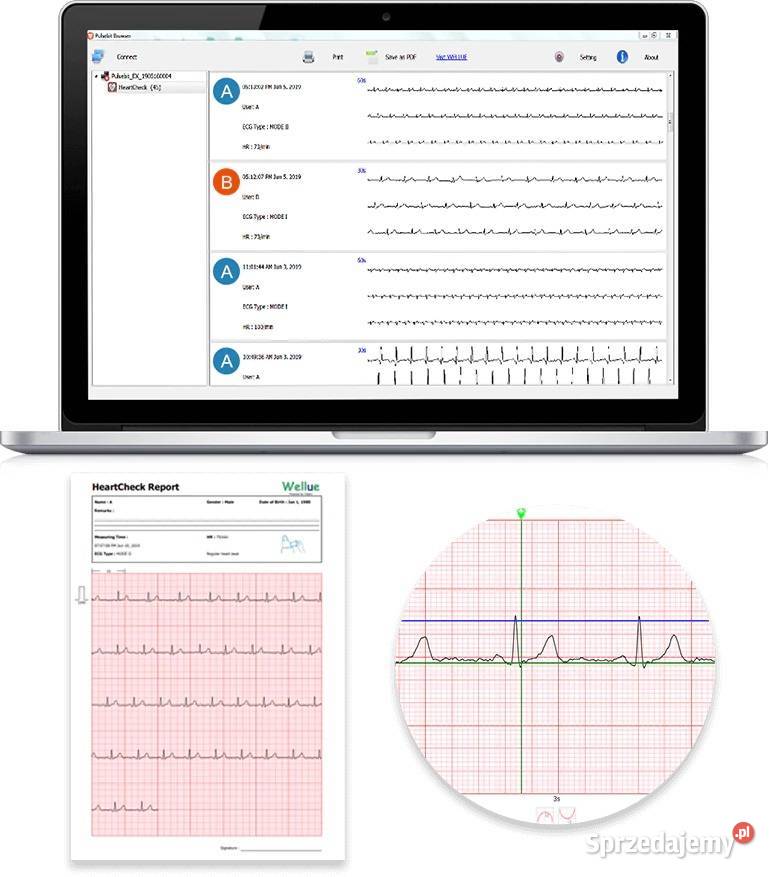 Przenośne Mobilne EKG Aparat Monitor Pulsebit śląskie Myszków
