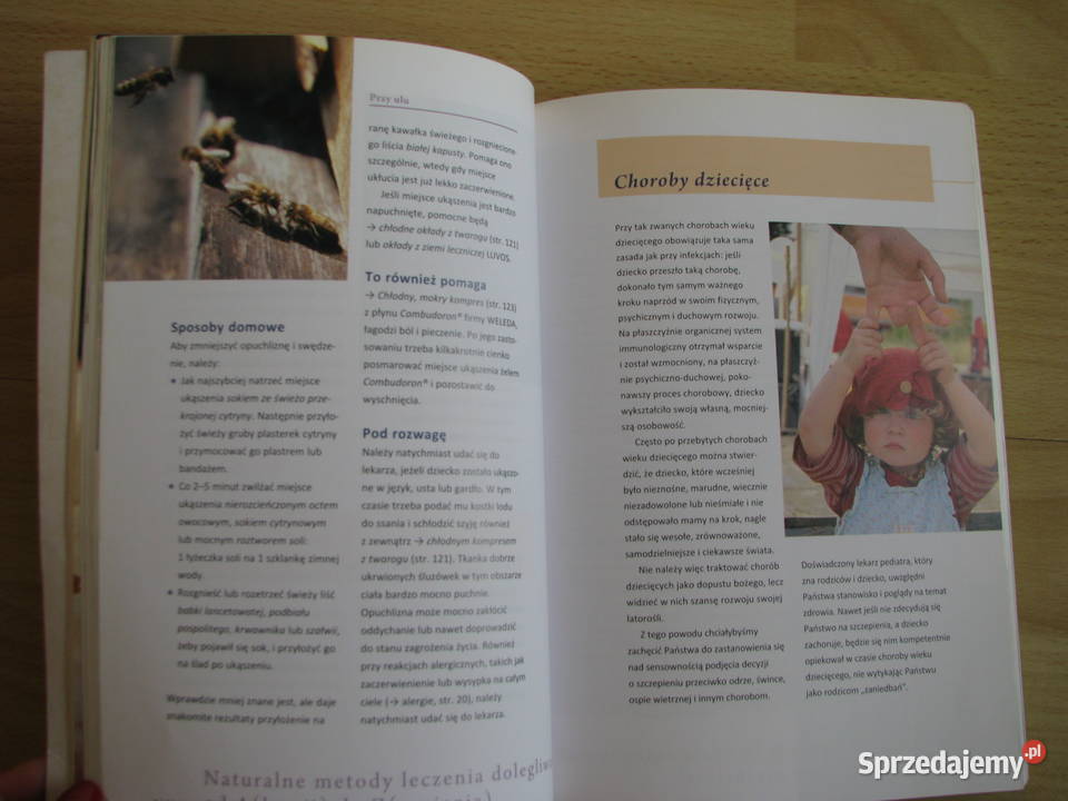 Choroby dziecięce Naturalne sposoby leczenia B miękka Brzegi