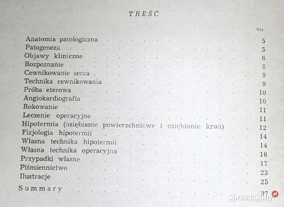 Leczenie operacyjne trylogii Fallota W Bross miękka Chełm
