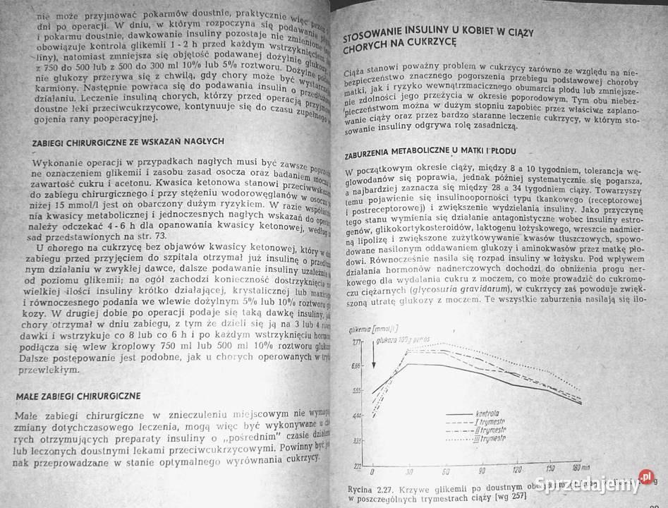 Farmakologiczne leczenie cukrzycy Teresa Chełm
