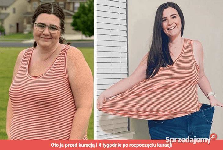 Slimmestar plastry na odchudzanie tanio PROMOCJA Poznań