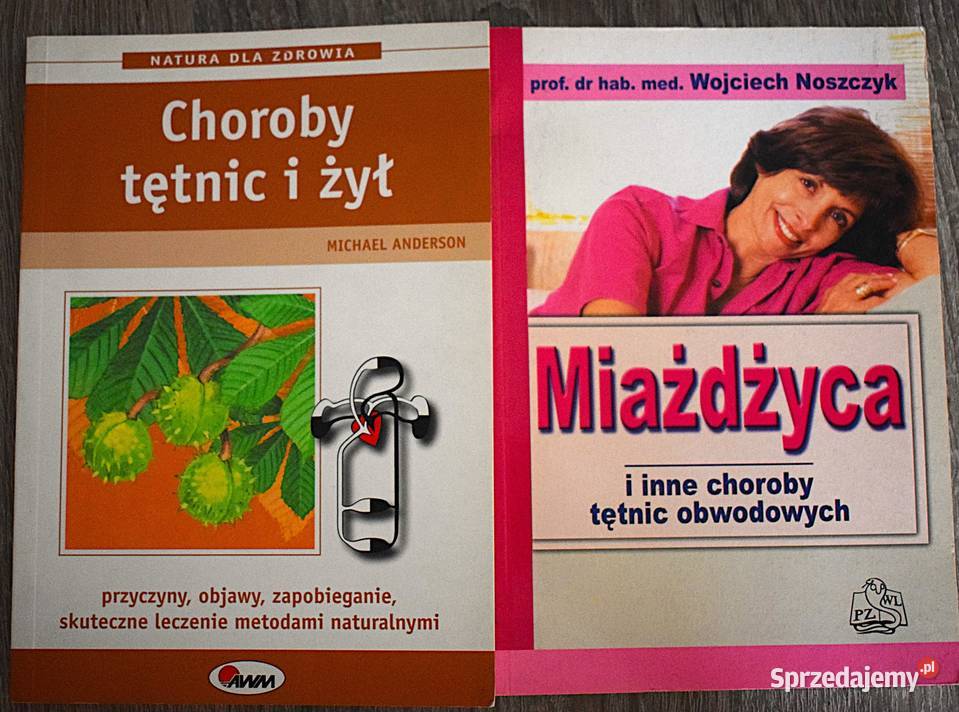 Miażdżyca choroby żył i tętnic przyczyny objawy Chełmno