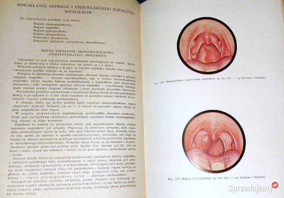 Diagnostyka szczegółowa chorób uszu nosa i Chełm