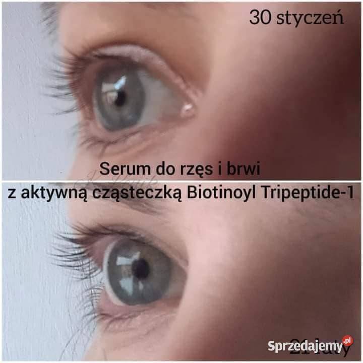 Serum do rzęs i brwi Bez Sterydów Nie uzależnia Dla kobiet Hajnówka