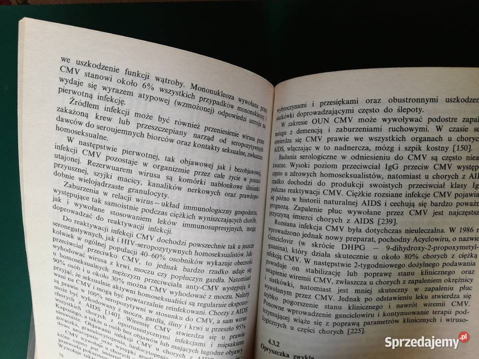 AIDS powstanie obraz kliniczny próby leczenia małopolskie