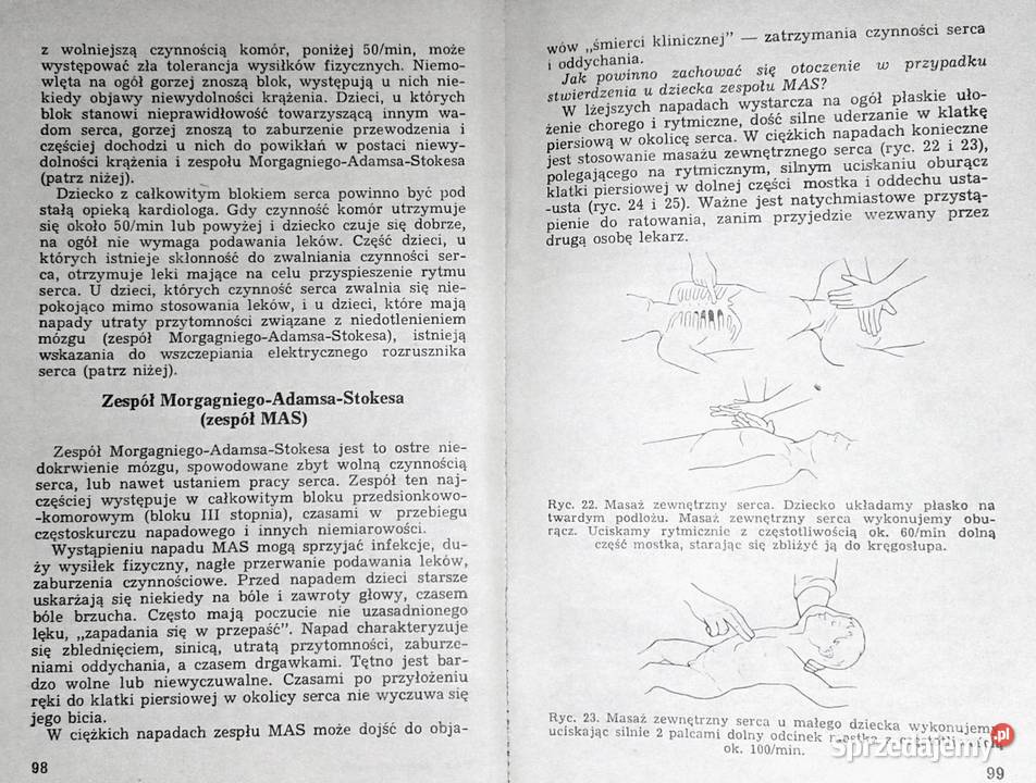 O chorobach serca u dzieci Krystyna Kubicka D Chełm