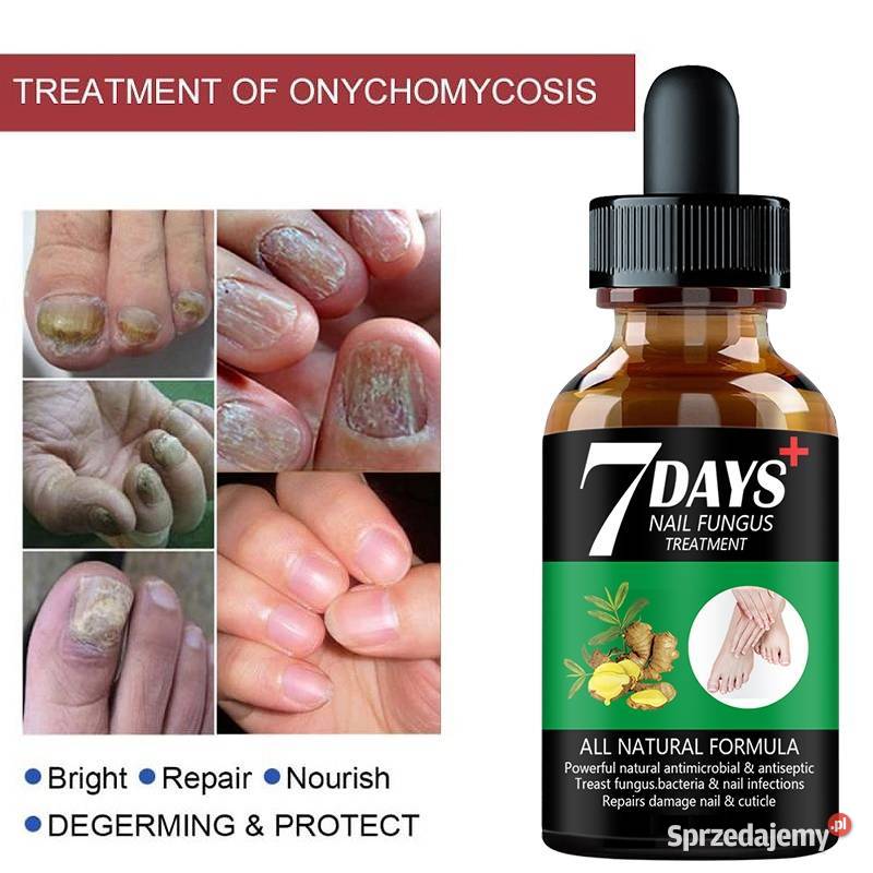 7days Serum przeciw grzybicy paznokci mazowieckie Płock