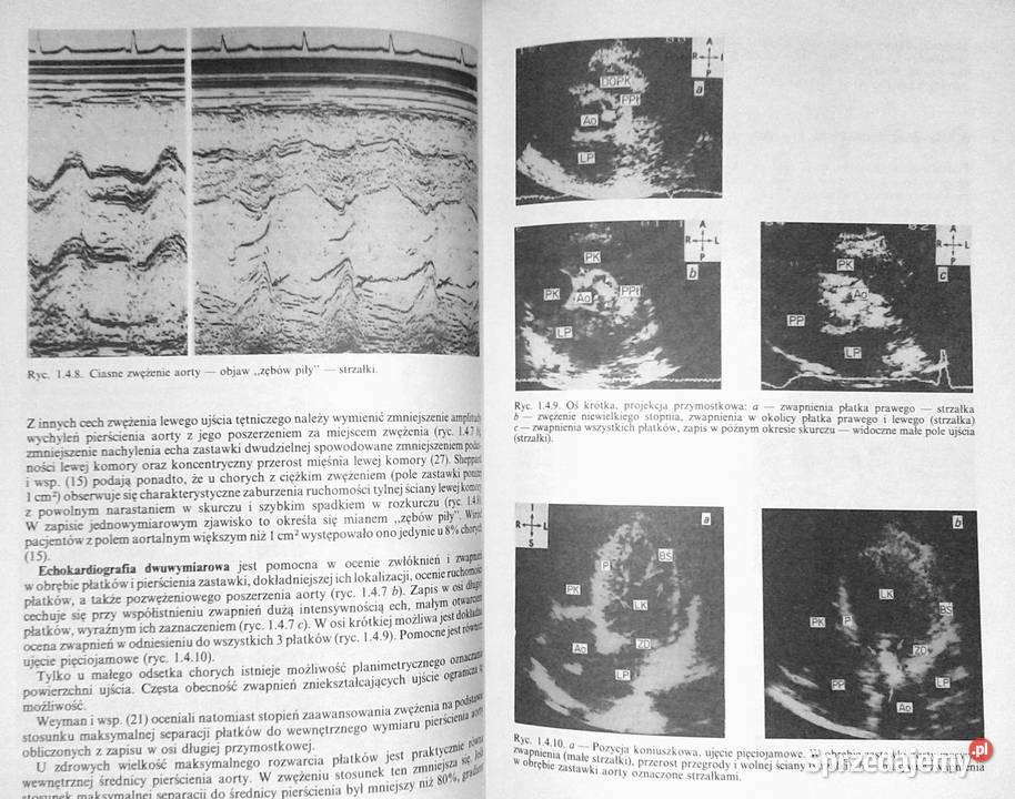 Metody obrazowe w diagnostyce chorób układu Chełm