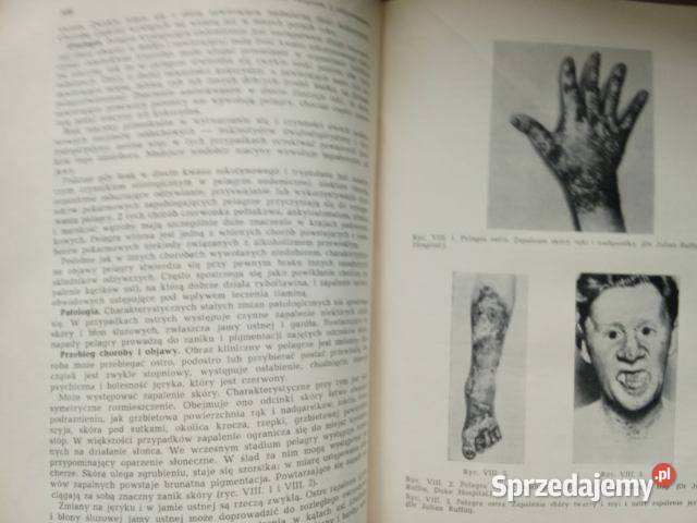 Medycyna tropikalna Hunter medycynachoroby medycyna, nauki medyczne Łódź sprzedam