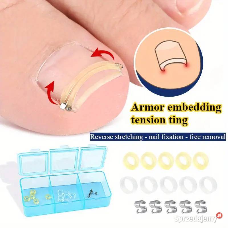 Wrastające Paznokcie Zestaw Korekcyjny AS Płock