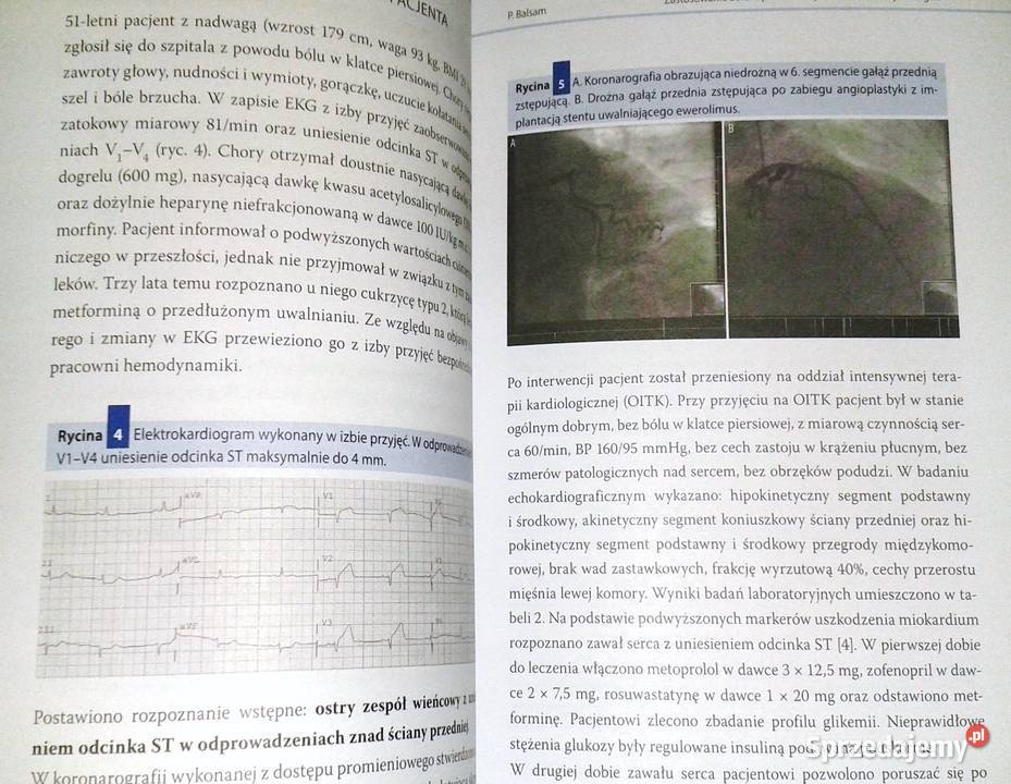 Komentarze do przypadków klinicznych w miękka Chełm