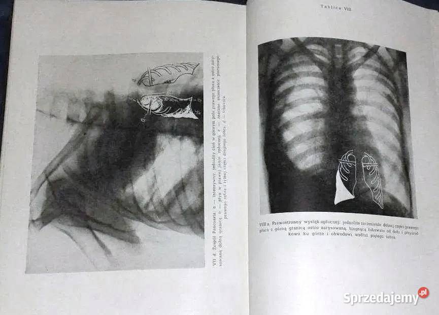 Nauka o chorobach wewnętrznych Tom 2 Witold E Chełm