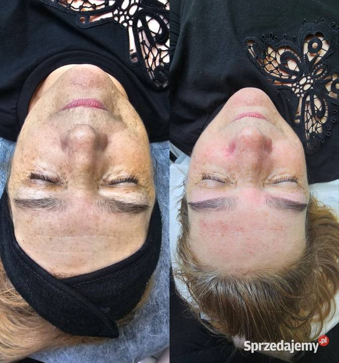 Oczyszczanie wodorowe Chorzów sprzedam