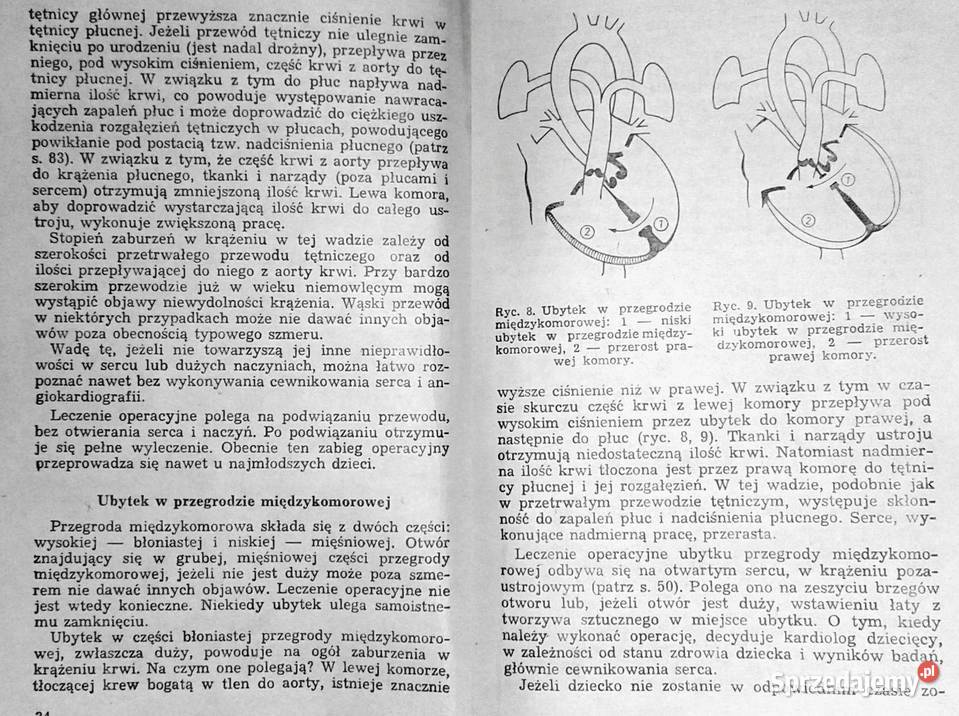 O chorobach serca u dzieci Krystyna Kubicka D Książki i Podręczniki Chełm sprzedam