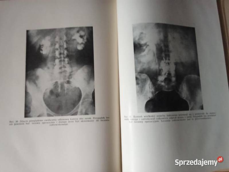 Balneologia kliniczna Jankowiak Fizykoterapia medycyna, nauki medyczne Łódź sprzedam