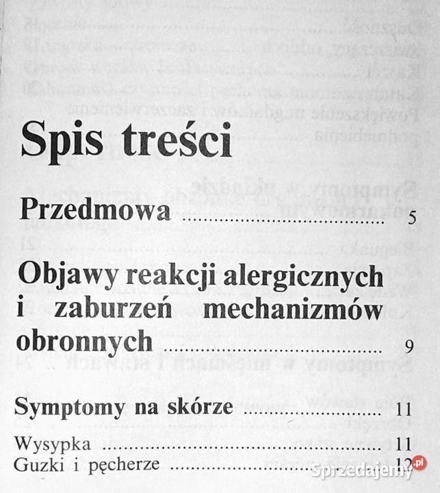 Kieszonkowa encyklopedia zdrowia i urody Alergie Rok wydania 1993 Chełm