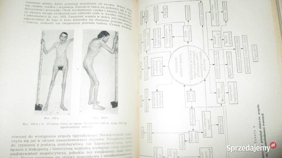 Choroby wewnętrznered H Dennig Berger medycyna