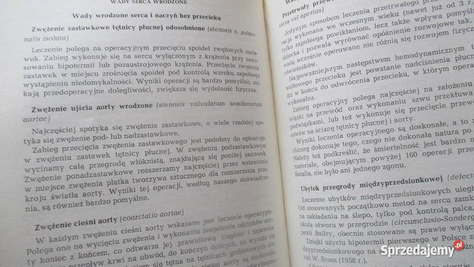 Podręcznik chorób wewnętrznych szczeklikmedycyna medycyna, nauki medyczne łódzkie Łódź sprzedam