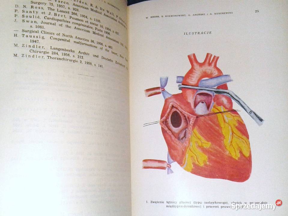 Leczenie operacyjne trylogii Fallota W Bross Rok wydania 1962 Chełm
