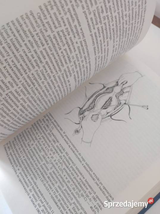 książka medyczna Choroby naczyń Henryk Rykowski Kielce