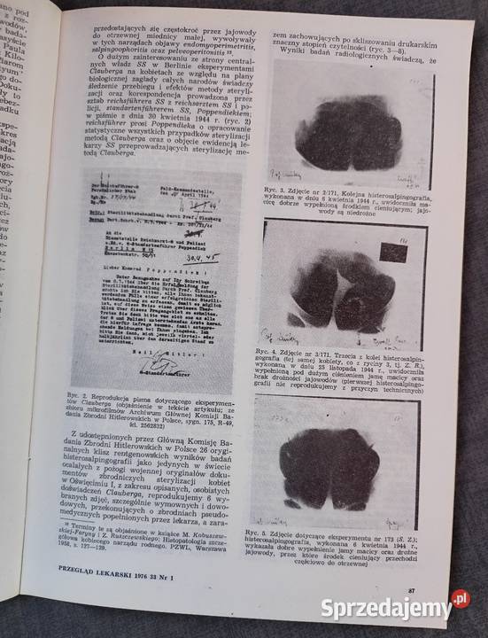 Przegląd lekarski Oświęcim z 1976 r Rok wydania 1976 Sosnowiec