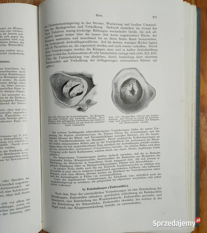 Lehrbuch der allgemeinen pathologie und der Sosnowiec