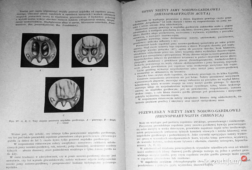 Diagnostyka szczegółowa chorób uszu nosa i Chełm