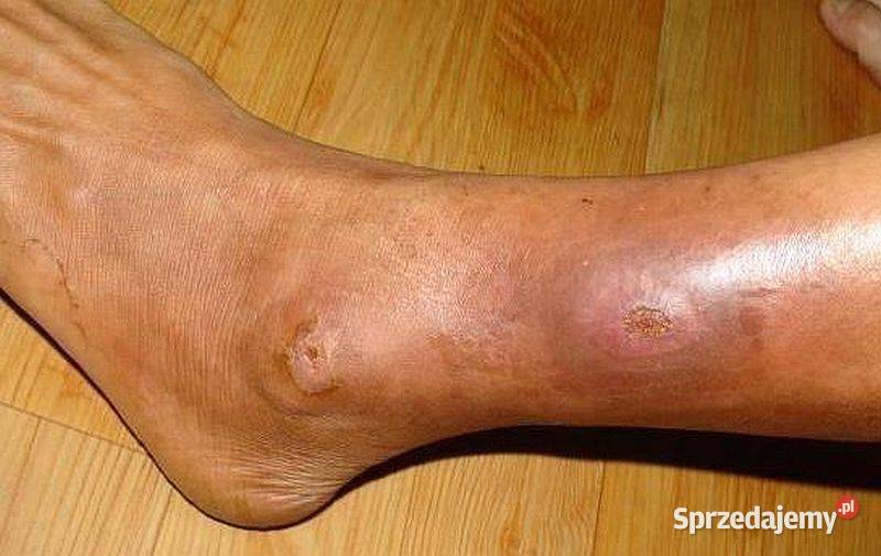 PLAZMA LIGHT lampa plazmowa nowej generacji dolnośląskie Wrocław