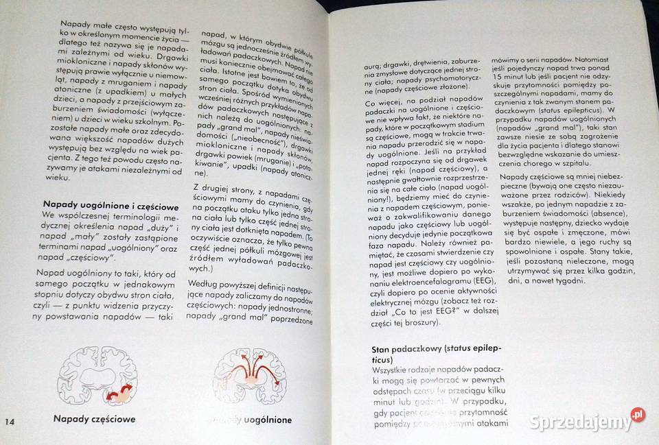 Nasze dziecko ma napady Padaczka u dzieci Ansgar Pozostałe Chełm