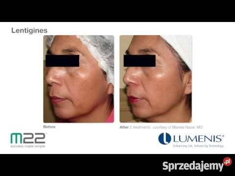 M22 Luenis Coherent Polska małopolskie