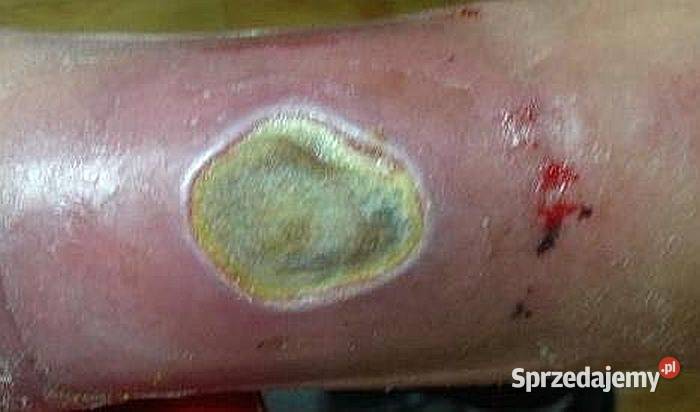 PLAZMA LIGHT lampa plazmowa nowej generacji Wrocław