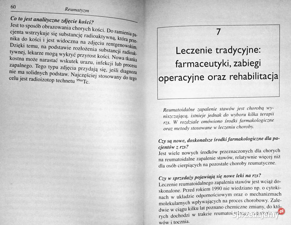 Reumatyzm Robert G Lahita Chełm
