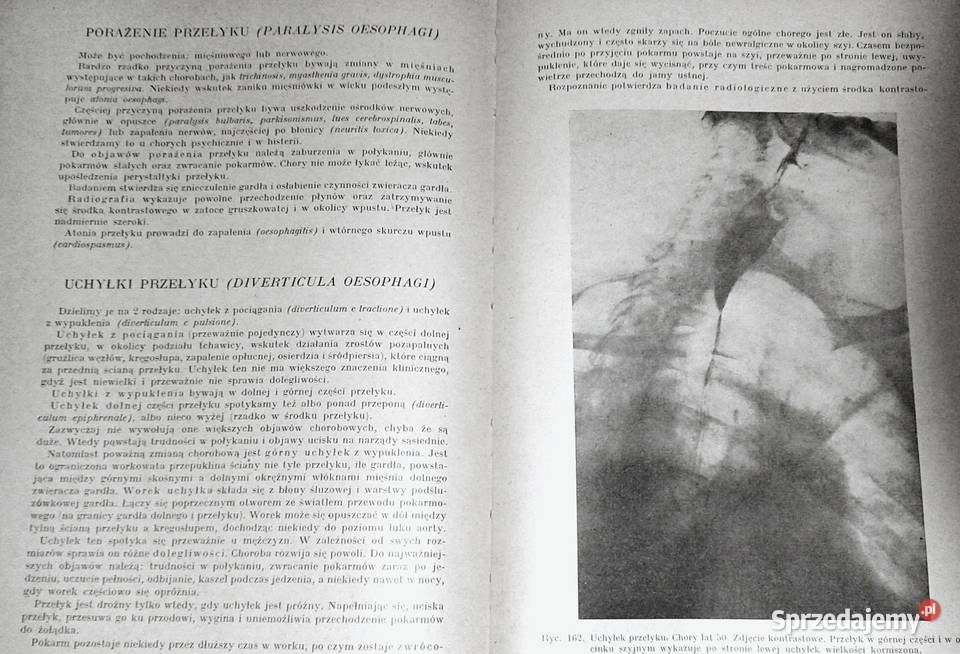 Diagnostyka szczegółowa chorób uszu nosa i lubelskie Chełm