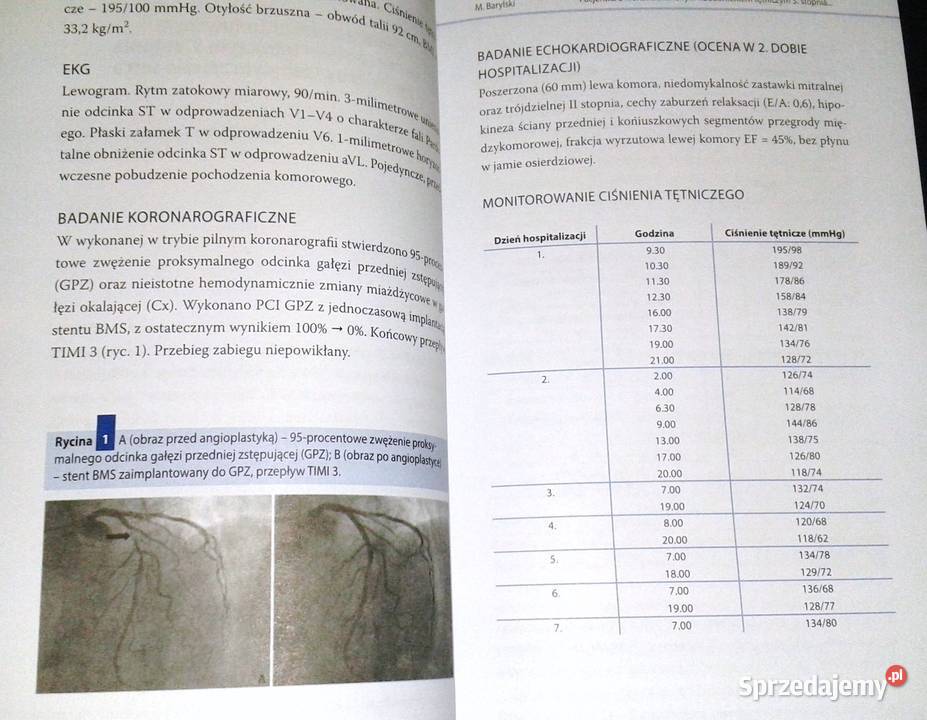 Komentarze do przypadków klinicznych w Chełm