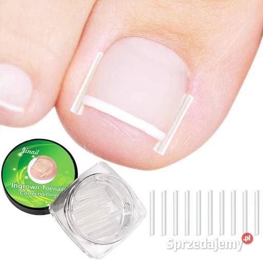 Podkładki silikonowe na wrastające paznokcie Płock